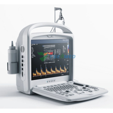 Ultrassom Doppler Digital Diagnóstico